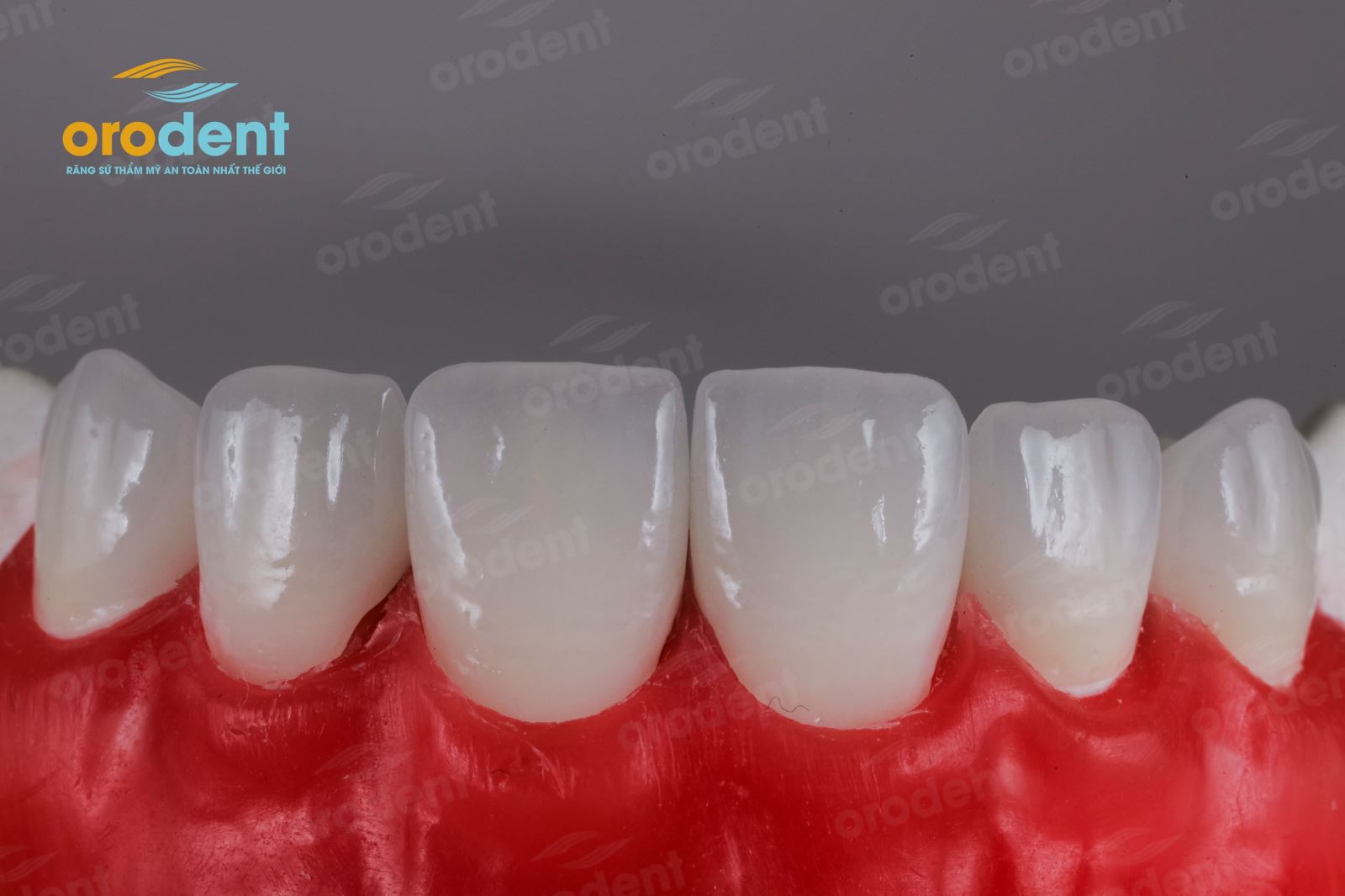 Orodent 3