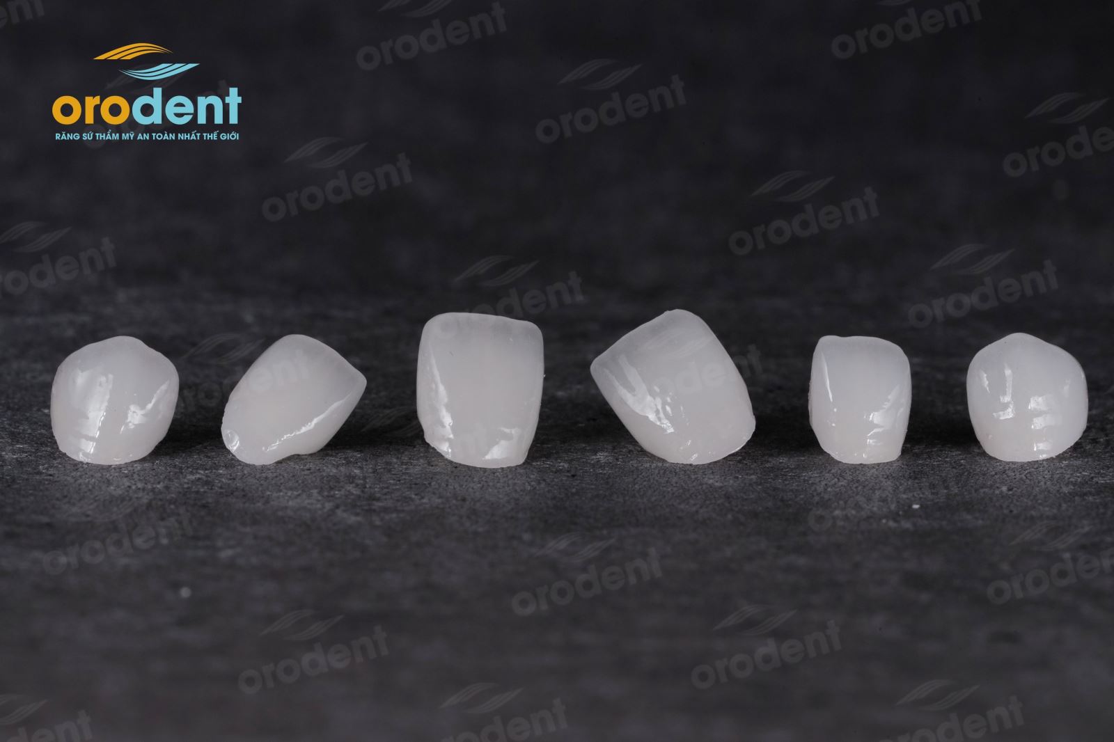 orodent 2